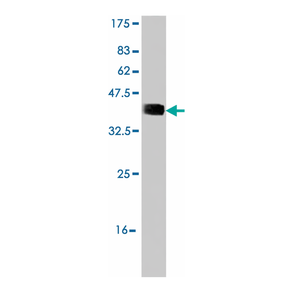 Merck Monoclonal Anti-RNF123 antibody produced in mouse