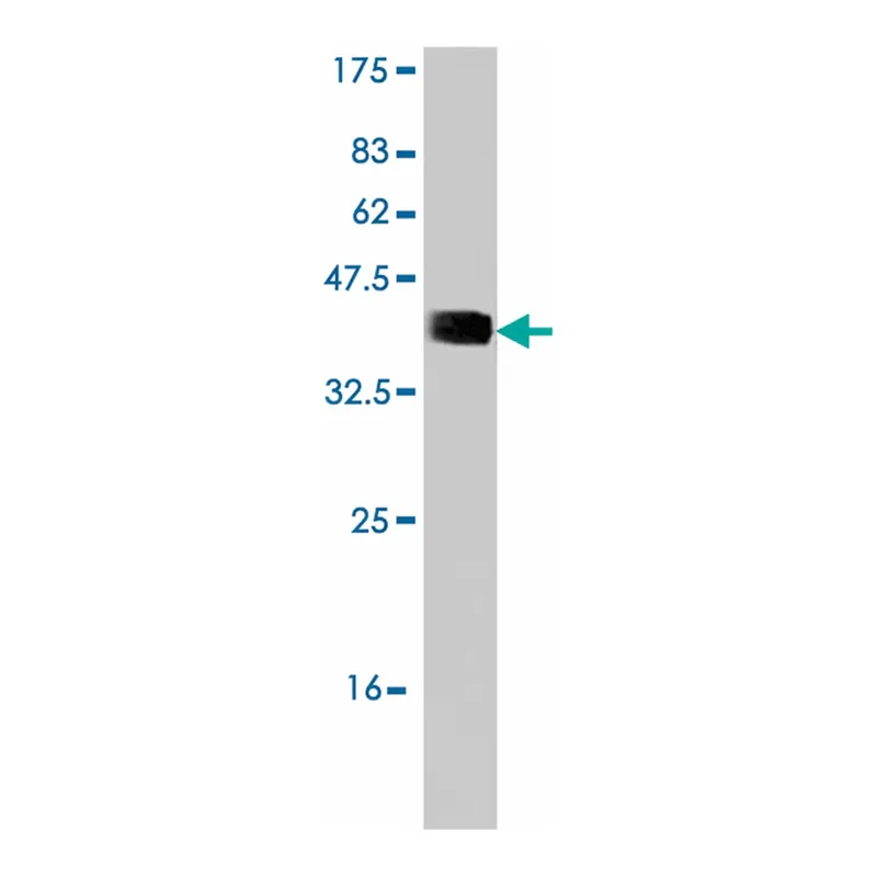 Merck Monoclonal Anti-RNF123 antibody produced in mouse