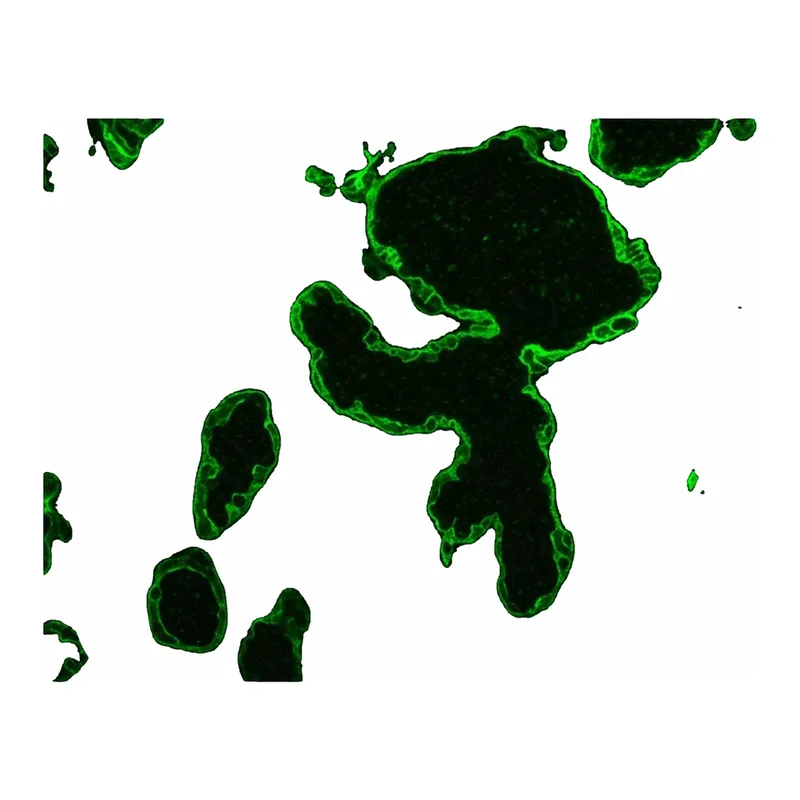 Merck MOUSE MONOCLONAL ANTI-CYTOKERATIN