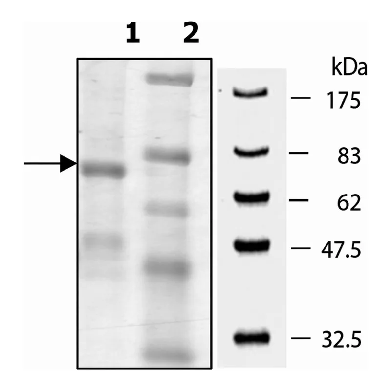Merck PADI-2 human