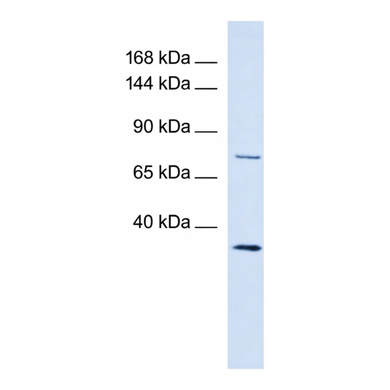 Merck Anti-SEMA6D antibody produced in rabbit