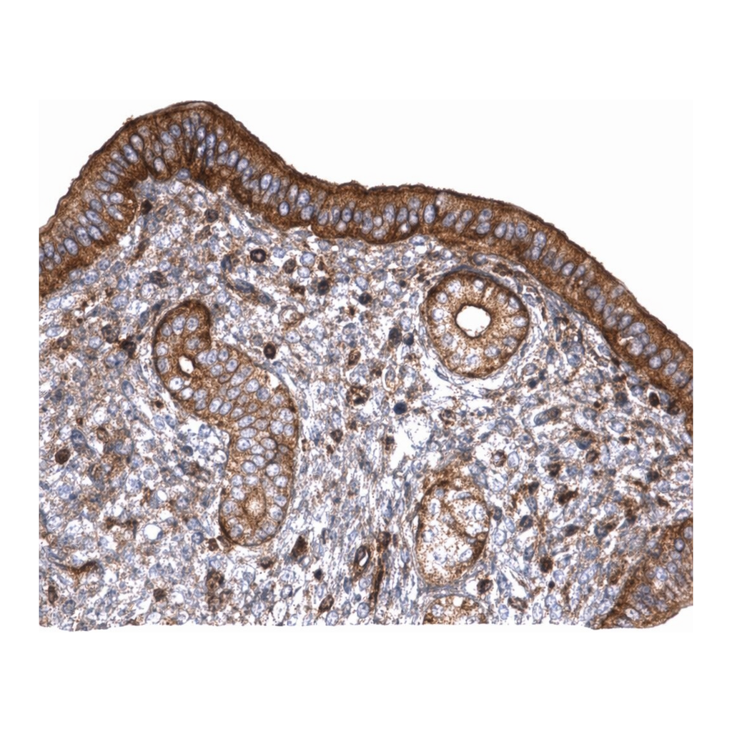 Merck Anti-PLS3 antibody produced in rabbit