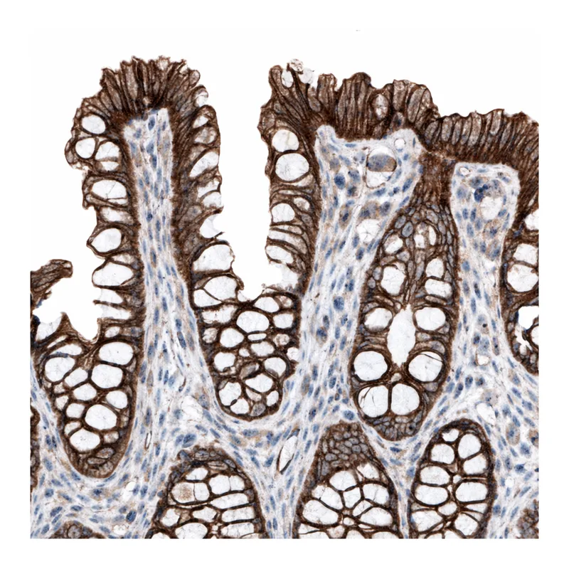 Merck Anti-GPR142 antibody produced in rabbit