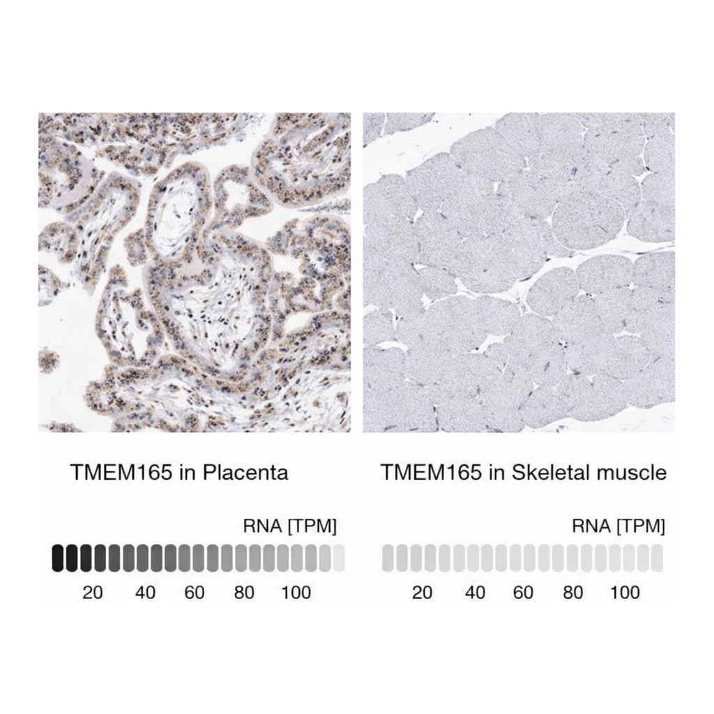 Merck Anti-TMEM165 antibody produced in rabbit