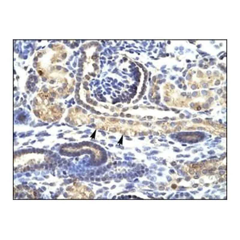 Merck ANTI-SNAI1
