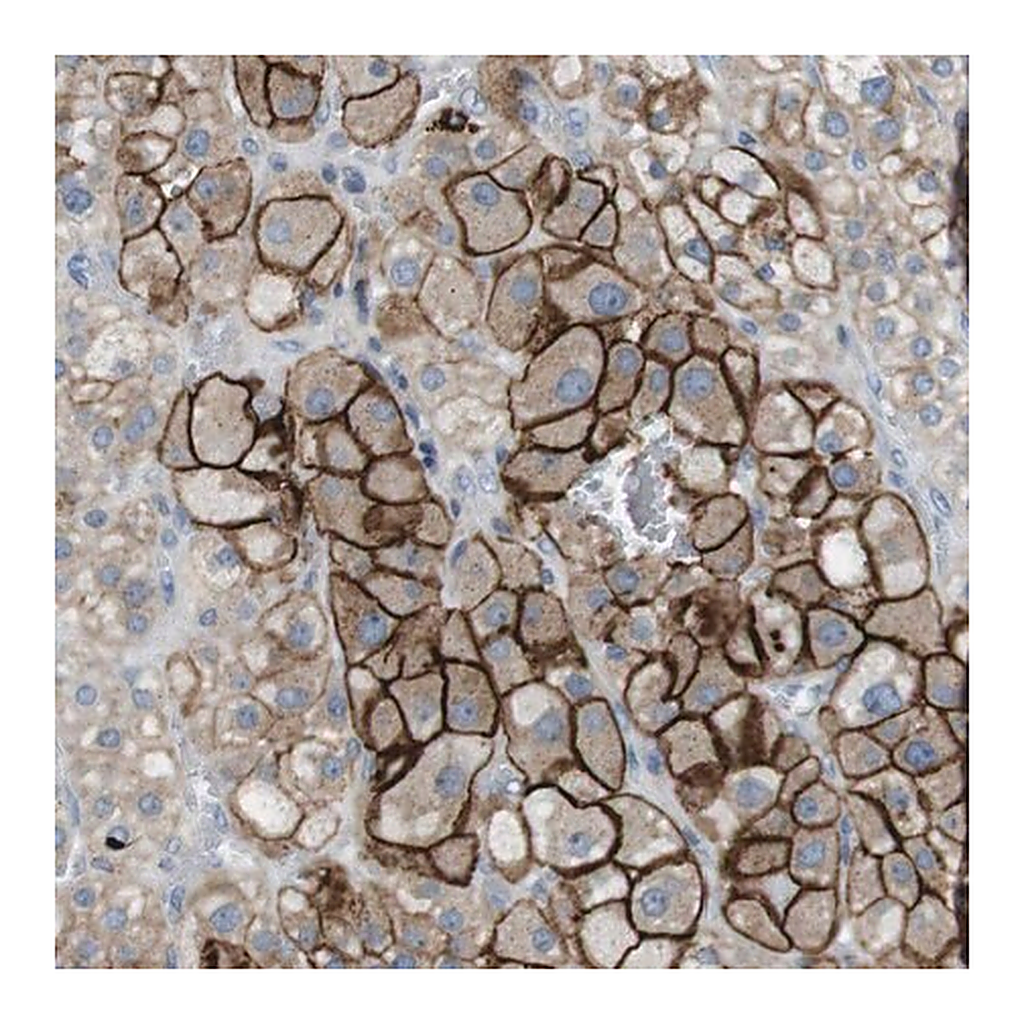 Merck Anti-TYW1 antibody produced in rabbit
