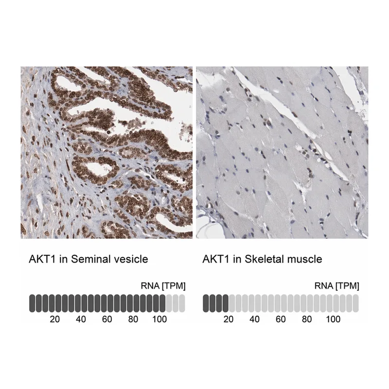 Merck Anti-AKT1 antibody produced in rabbit