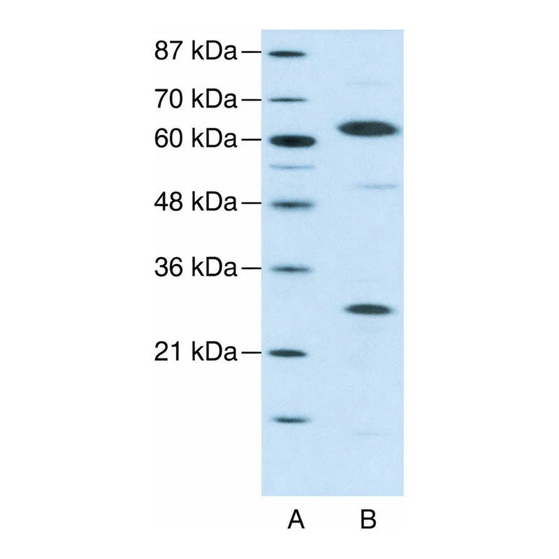 Merck Anti-HMGB4 antibody produced in rabbit