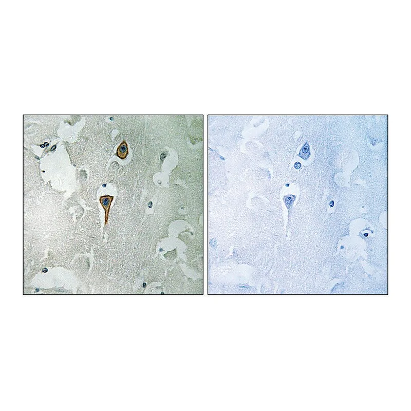 Merck Anti-NMDAR1 antibody produced in rabbit