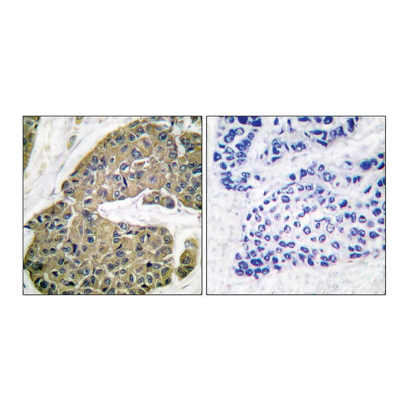 Merck Anti-Keratin 5 antibody produced in rabbit