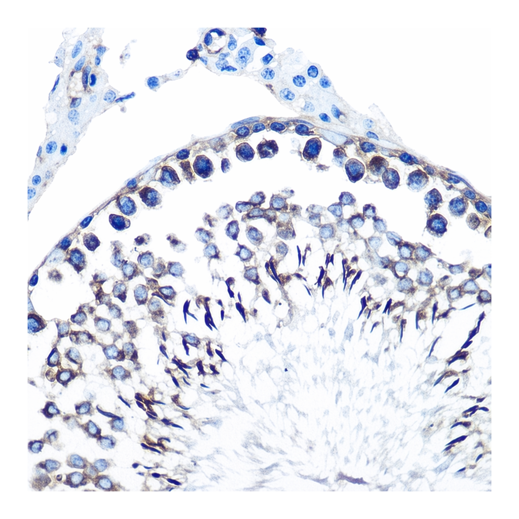 Merck Anti-CCR7 antibody produced in rabbit