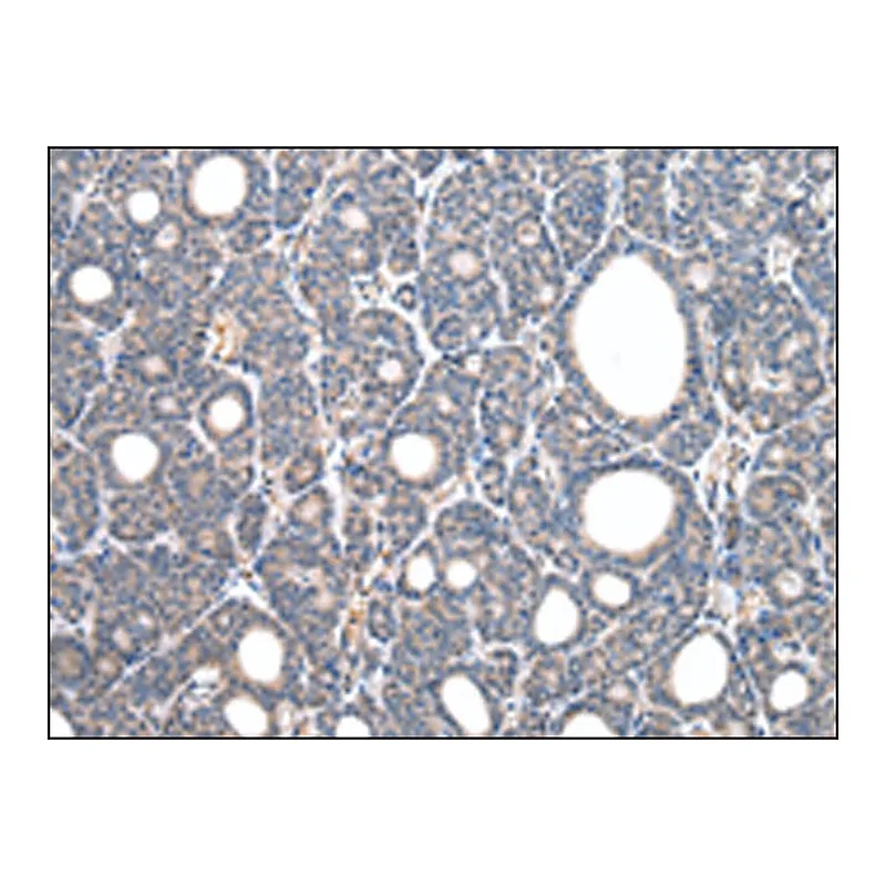 Merck Anti-CD14