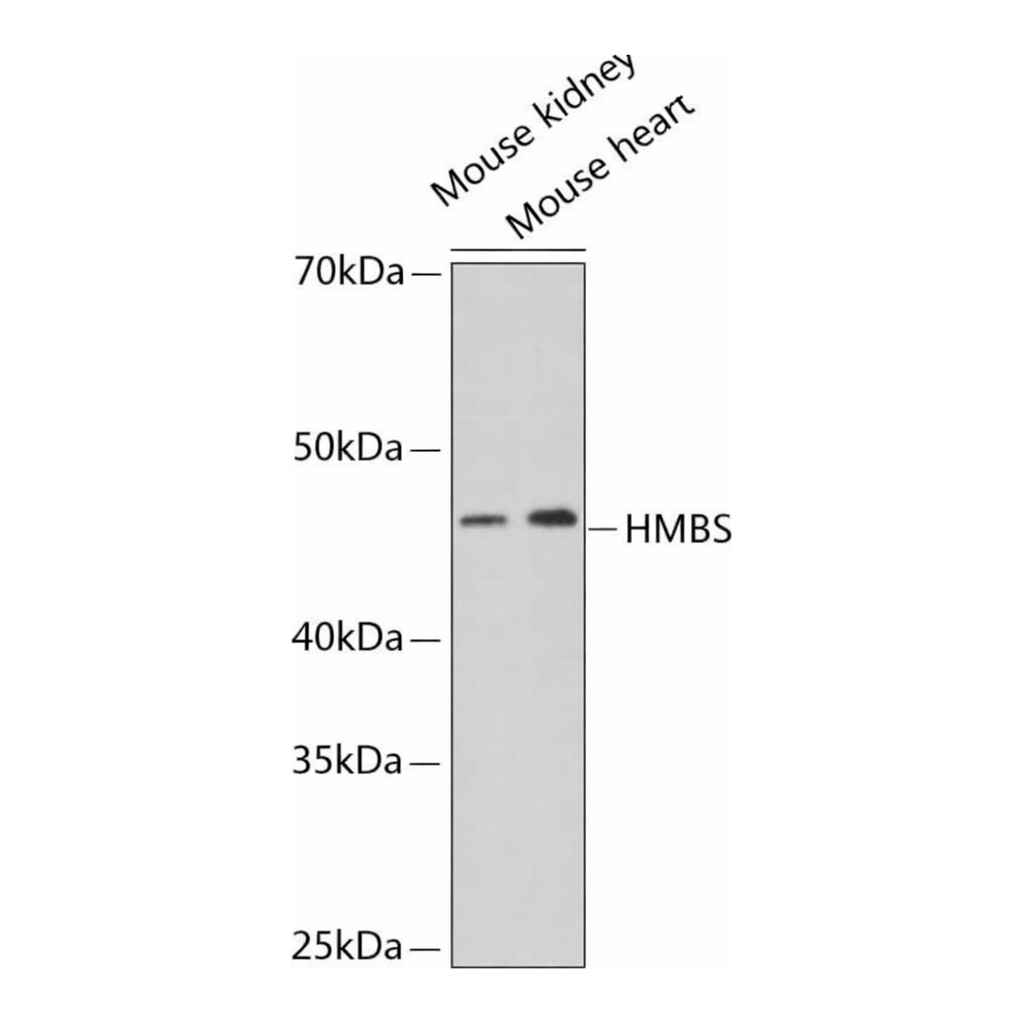 Merck Anti-HMBS antibody produced in rabbit