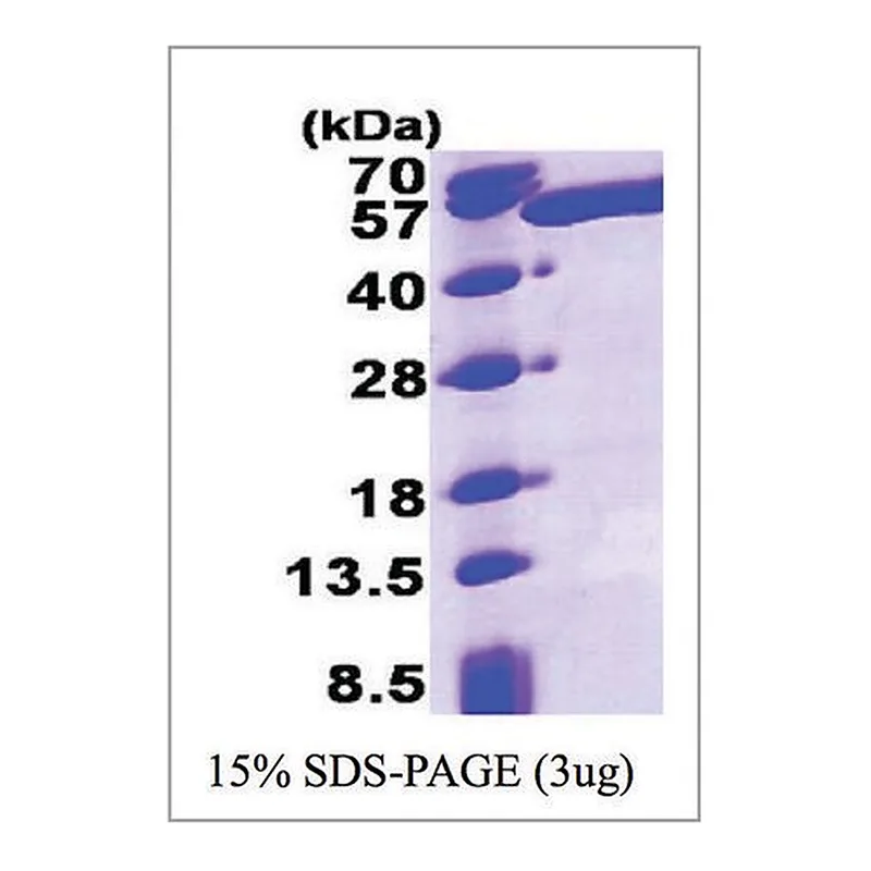 Merck ALDH3A1 human
