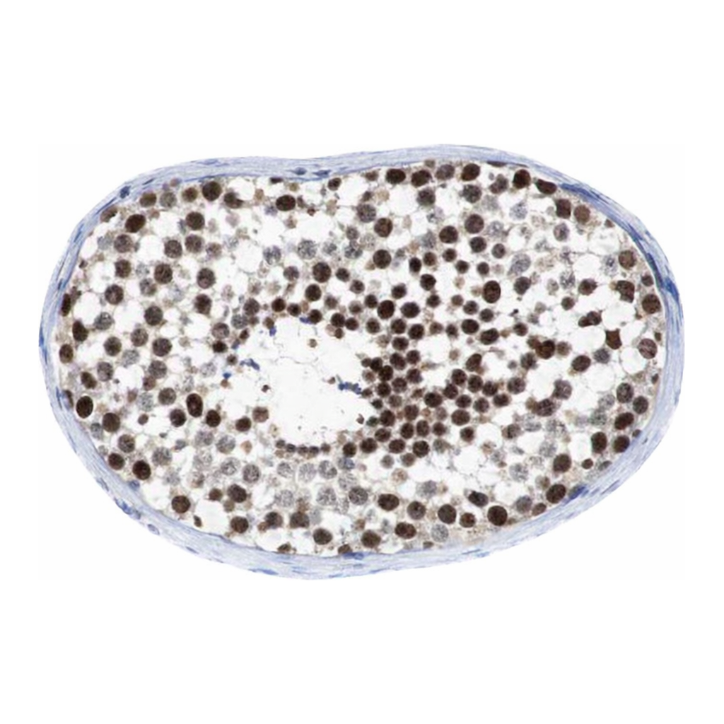Merck Anti-PSME3 antibody produced in rabbit