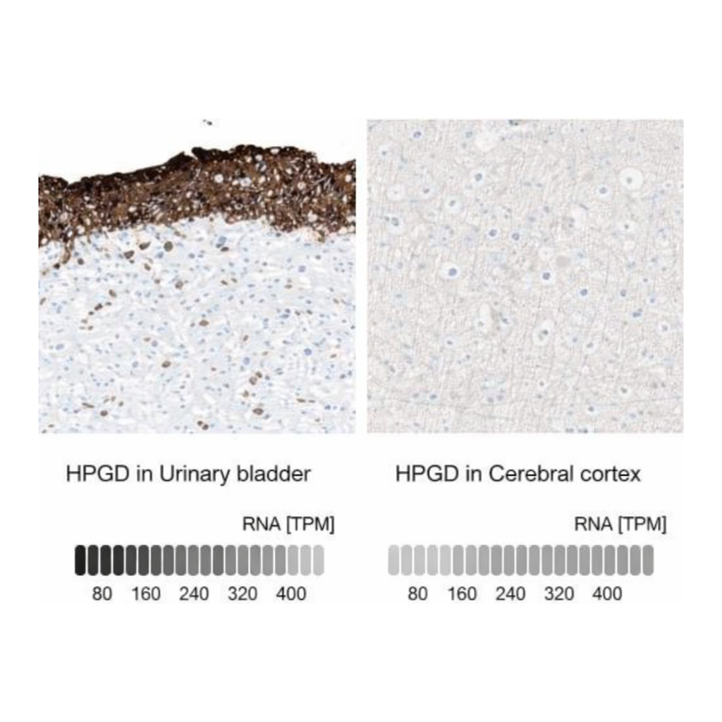 Merck Anti-HPGD antibody produced in rabbit