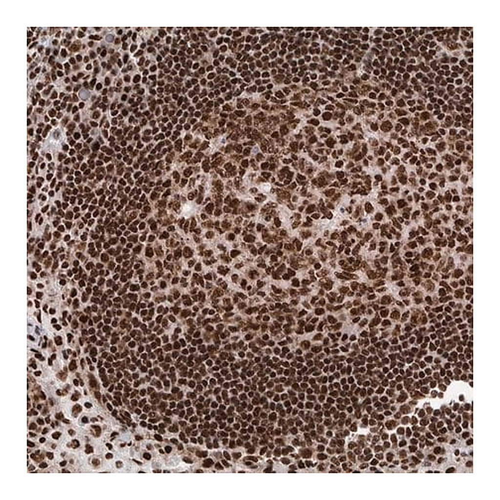 Merck Anti-DNMT3A antibody produced in rabbit