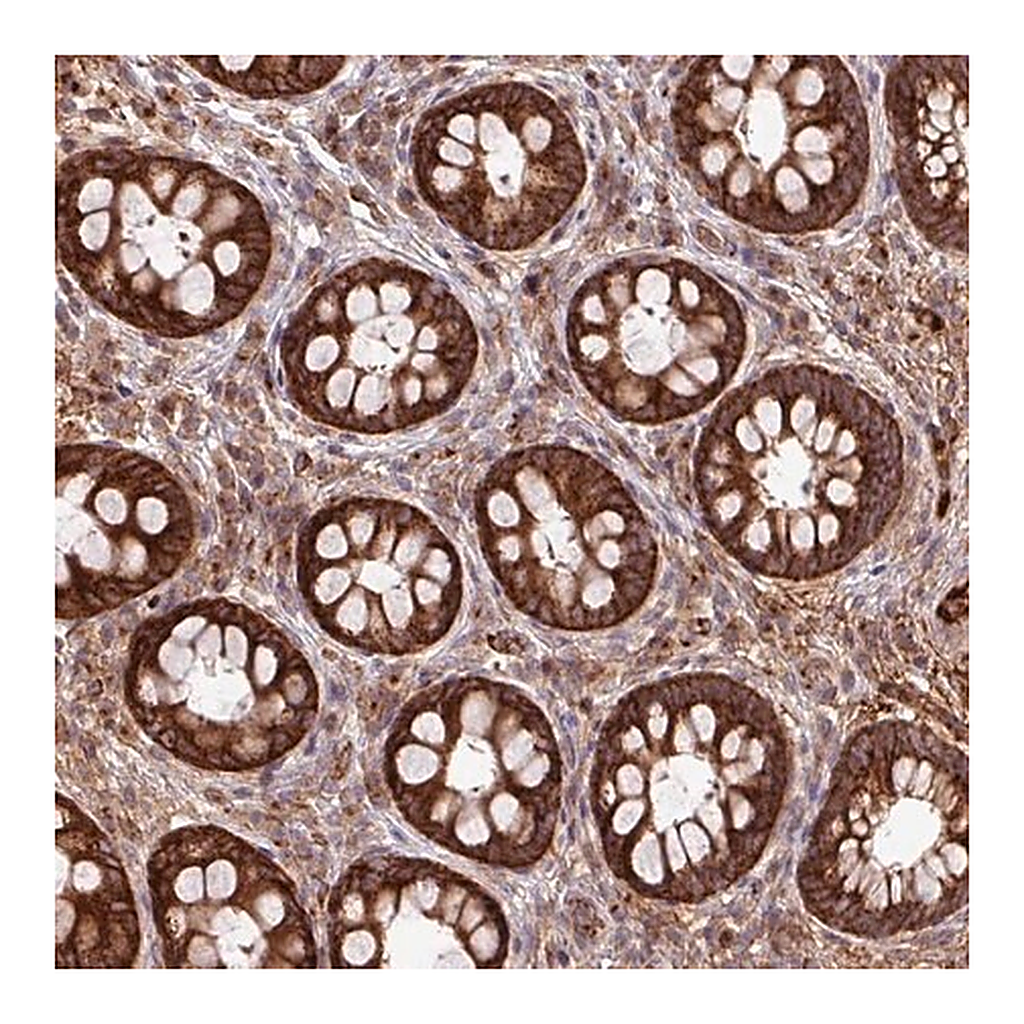 Merck Anti-LSM12 antibody produced in rabbit