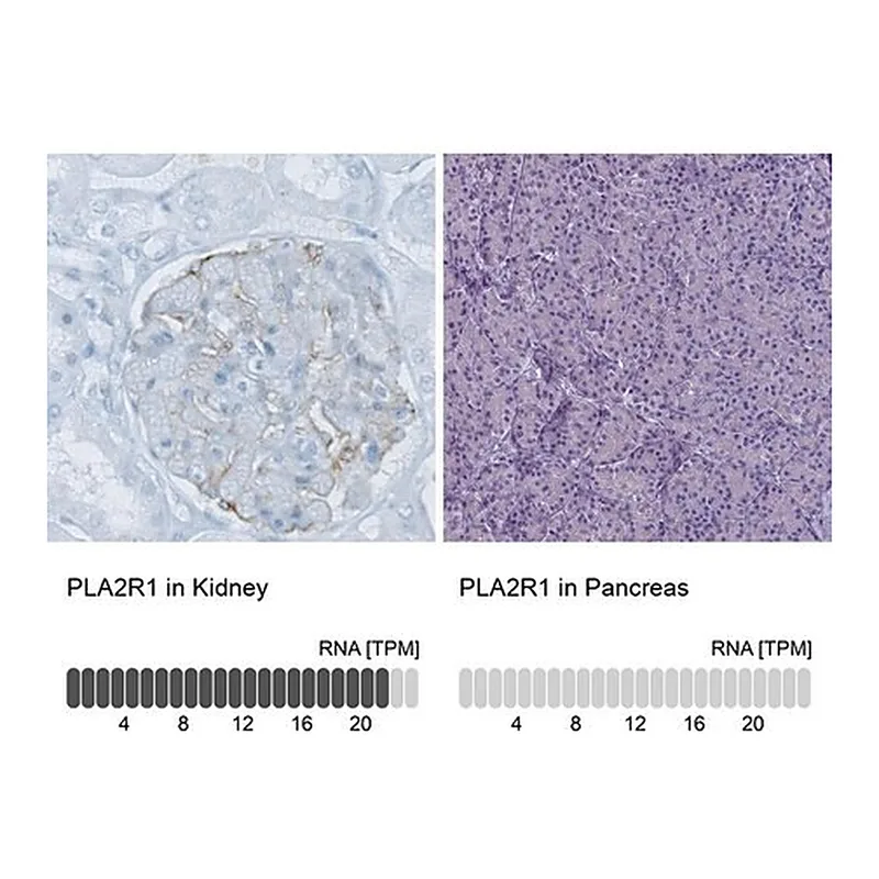 Merck Monoclonal Anti-PLA2R1 antibody produced in mouse