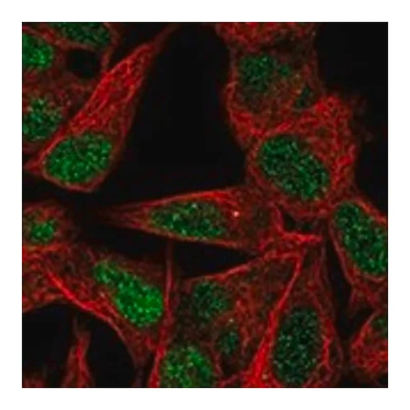 Merck Anti-TGIF2 antibody produced in rabbit