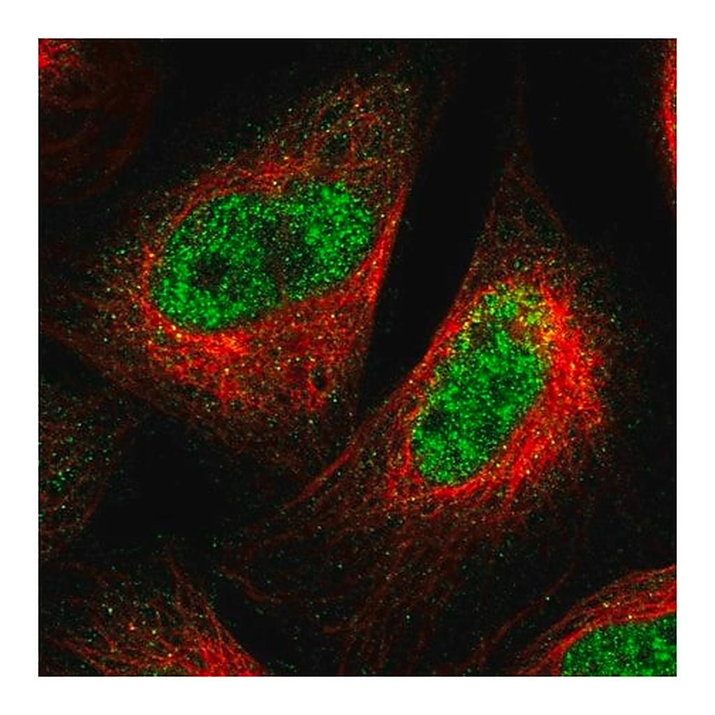 Merck Anti-SPRTN antibody produced in rabbit