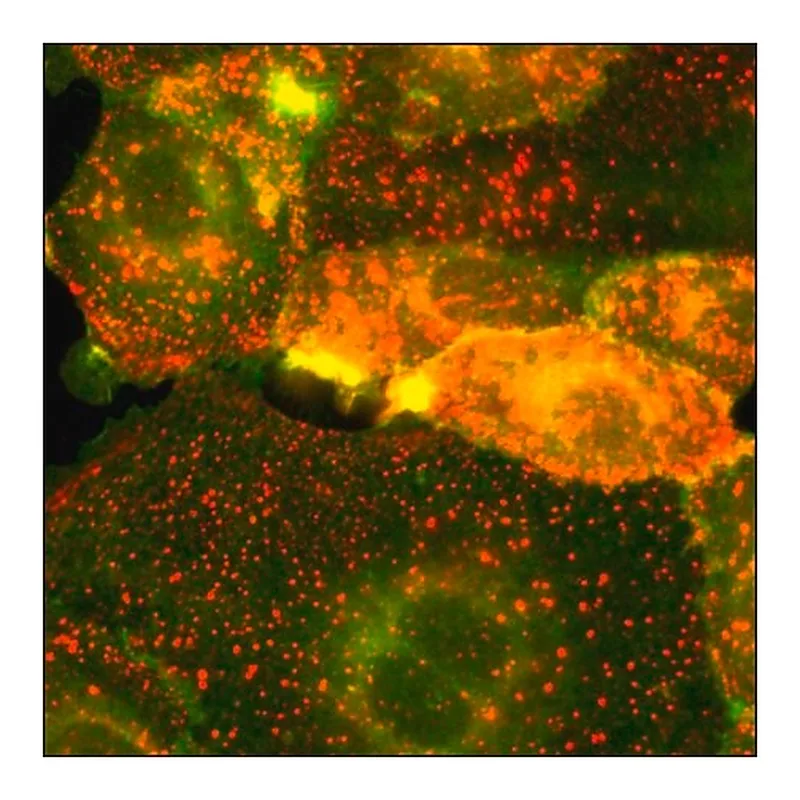 Merck SKOV3 Cells GFP-HER2 RFP-EGFR