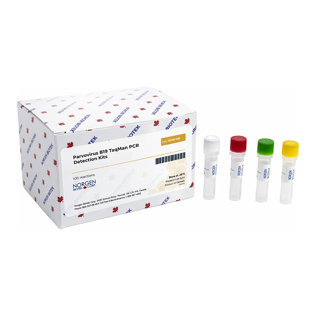Norgen Parvo B19 TaqMan Probe/Primer and Control Set