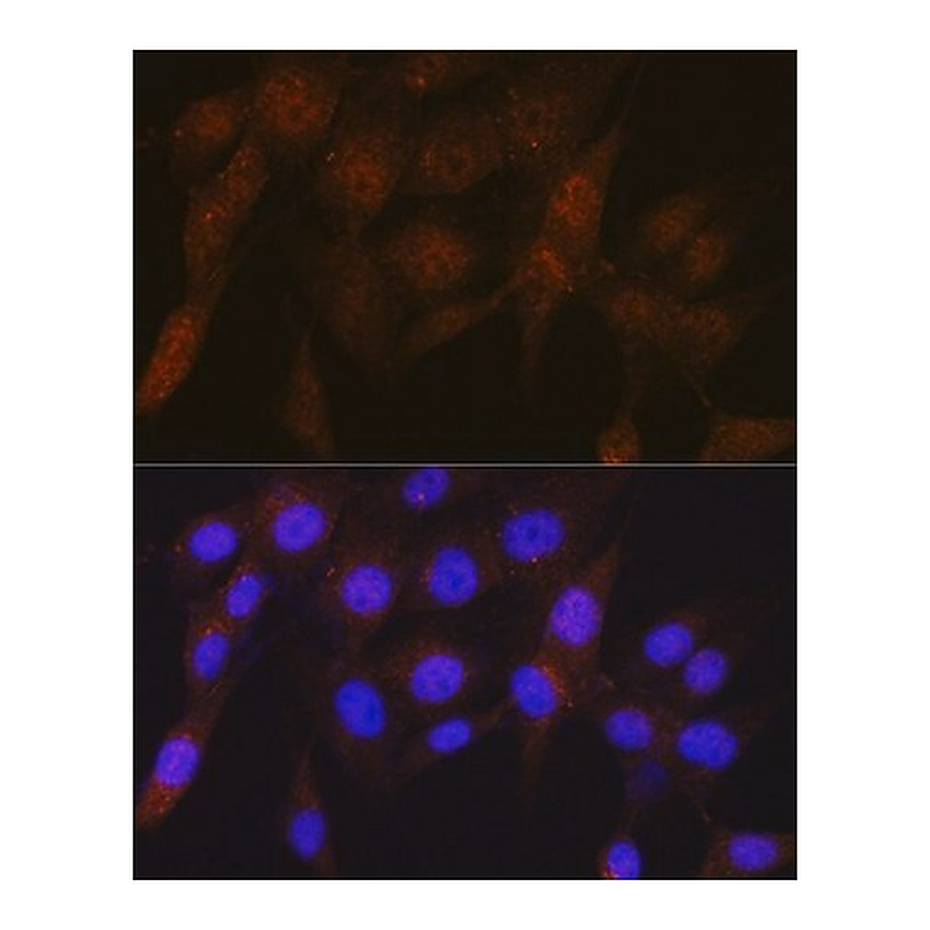 Merck Anti-PSMD4 antibody produced in rabbit