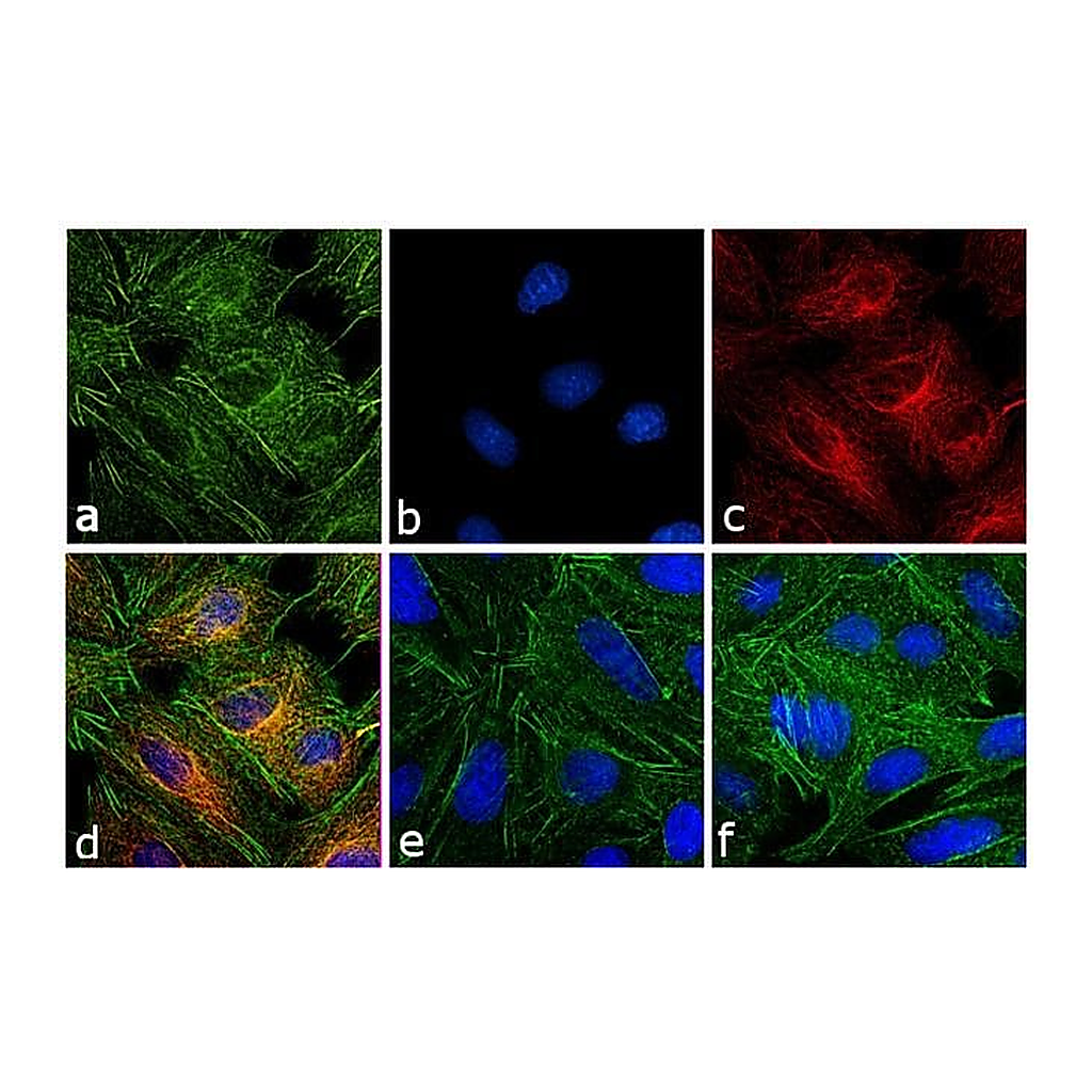 Thermo Fisher Scientific Goat anti-Rat IgG (H+L) Secondary Antibody, Rhodamine