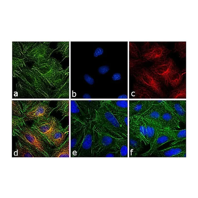 Thermo Fisher Scientific Goat anti-Rat IgG (H+L) Secondary Antibody, Rhodamine