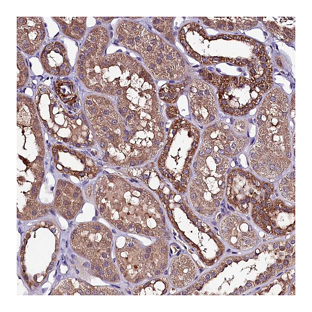 Atlas Antibodies Anti-NARFL Antibody