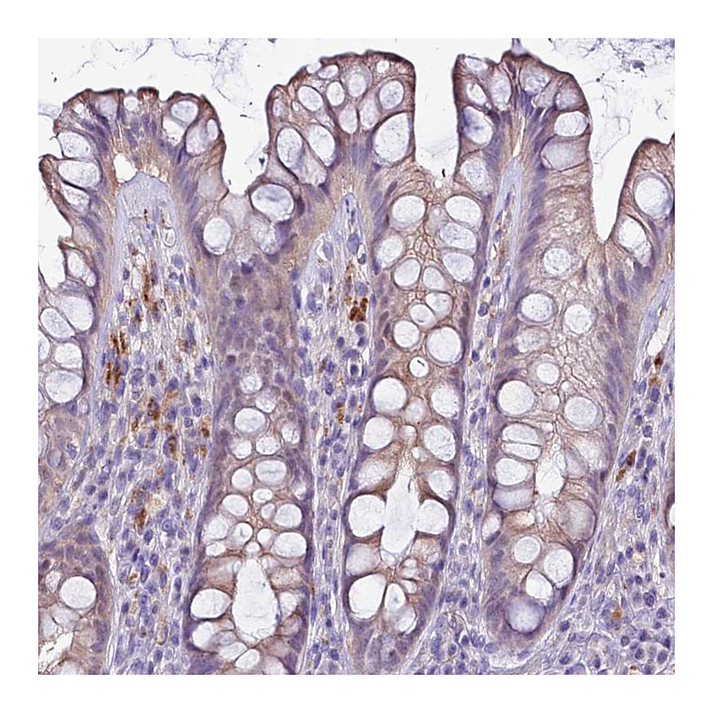 Atlas Antibodies Anti-NAT1 Antibody