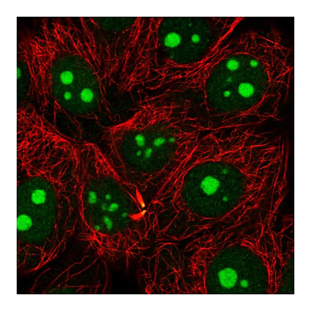 Atlas Antibodies Anti-NAT10 Antibody