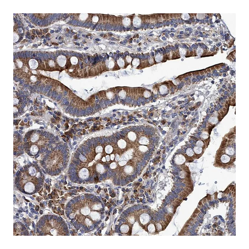 Atlas Antibodies Anti-NAT16 Antibody