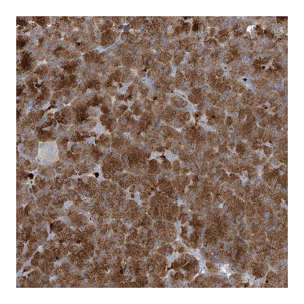 Atlas Antibodies Anti-NAV3 Antibody