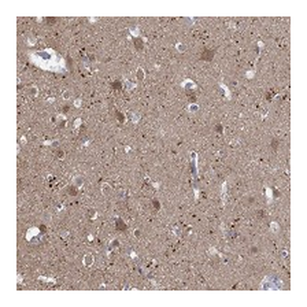Atlas Antibodies Anti-NAV3 Antibody