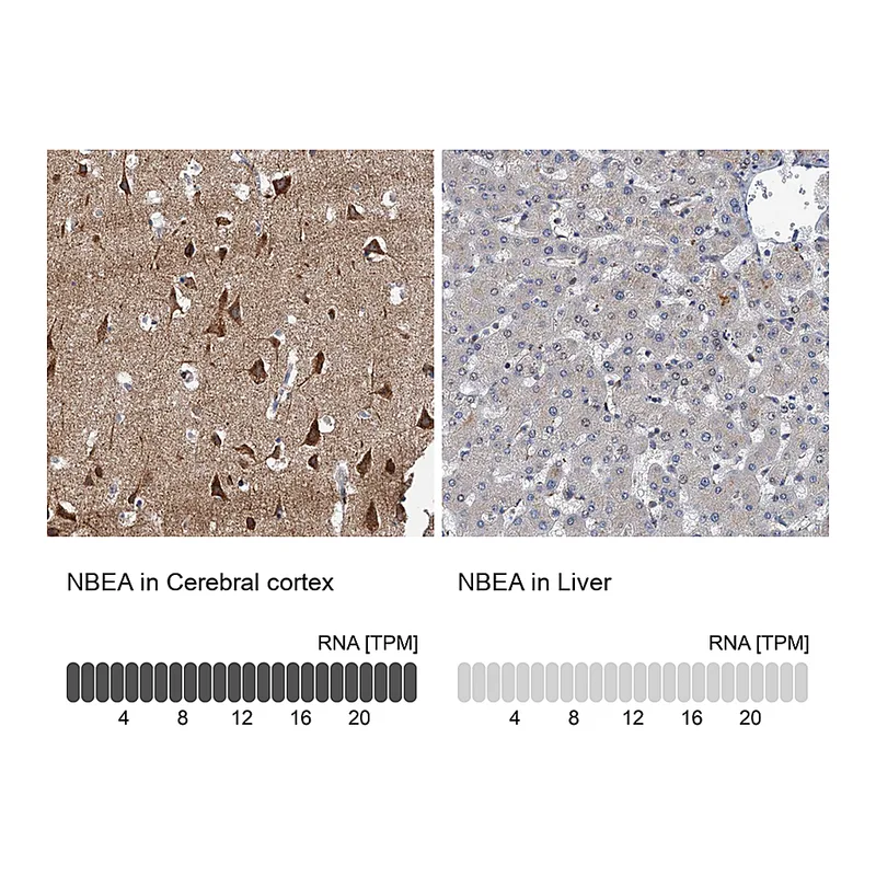 Atlas Antibodies Anti-NBEA Antibody