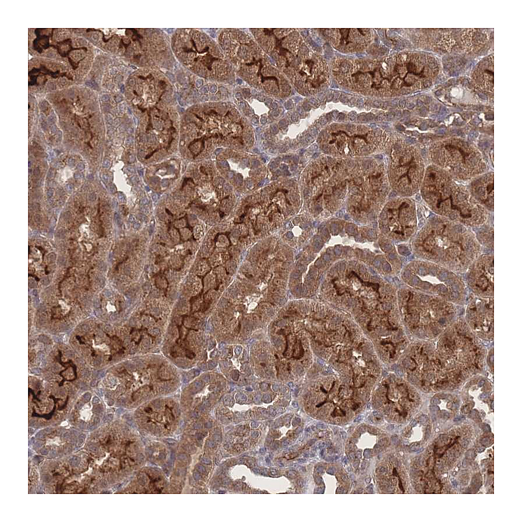 Atlas Antibodies Anti-NBEAL1 Antibody