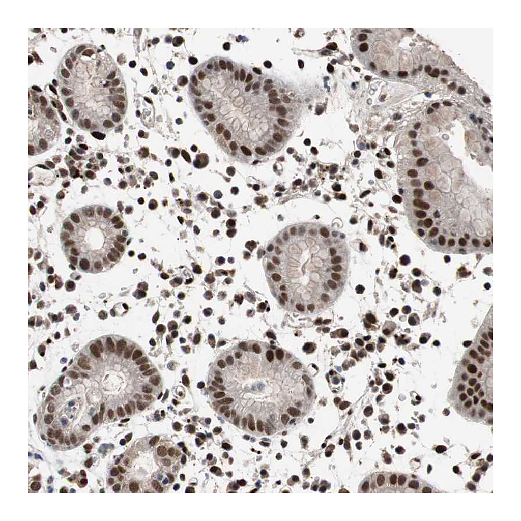 Atlas Antibodies Anti-NBL1 Antibody