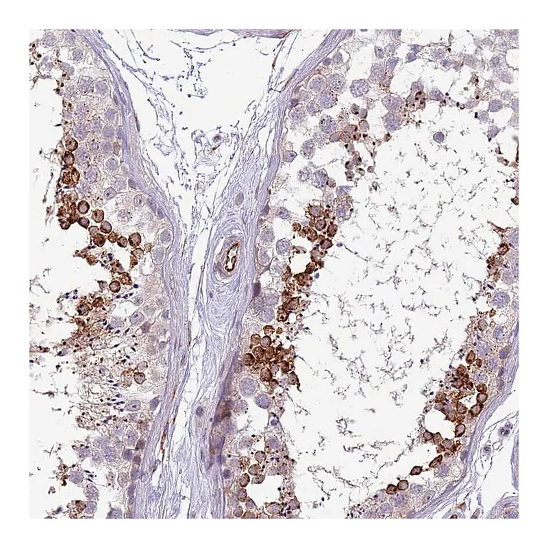 Atlas Antibodies Anti-NBPF3 Antibody