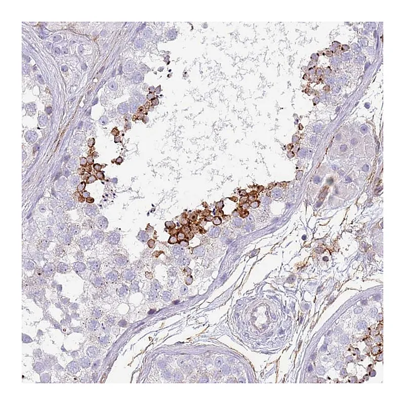 Atlas Antibodies Anti-NBPF3 Antibody
