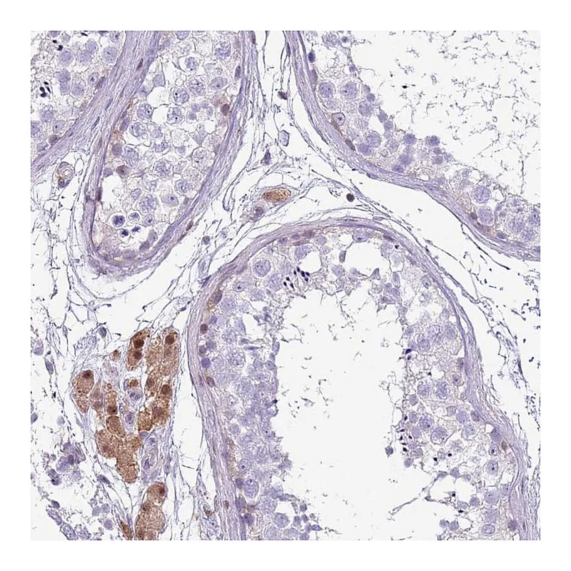 Atlas Antibodies Anti-NBPF6 Antibody