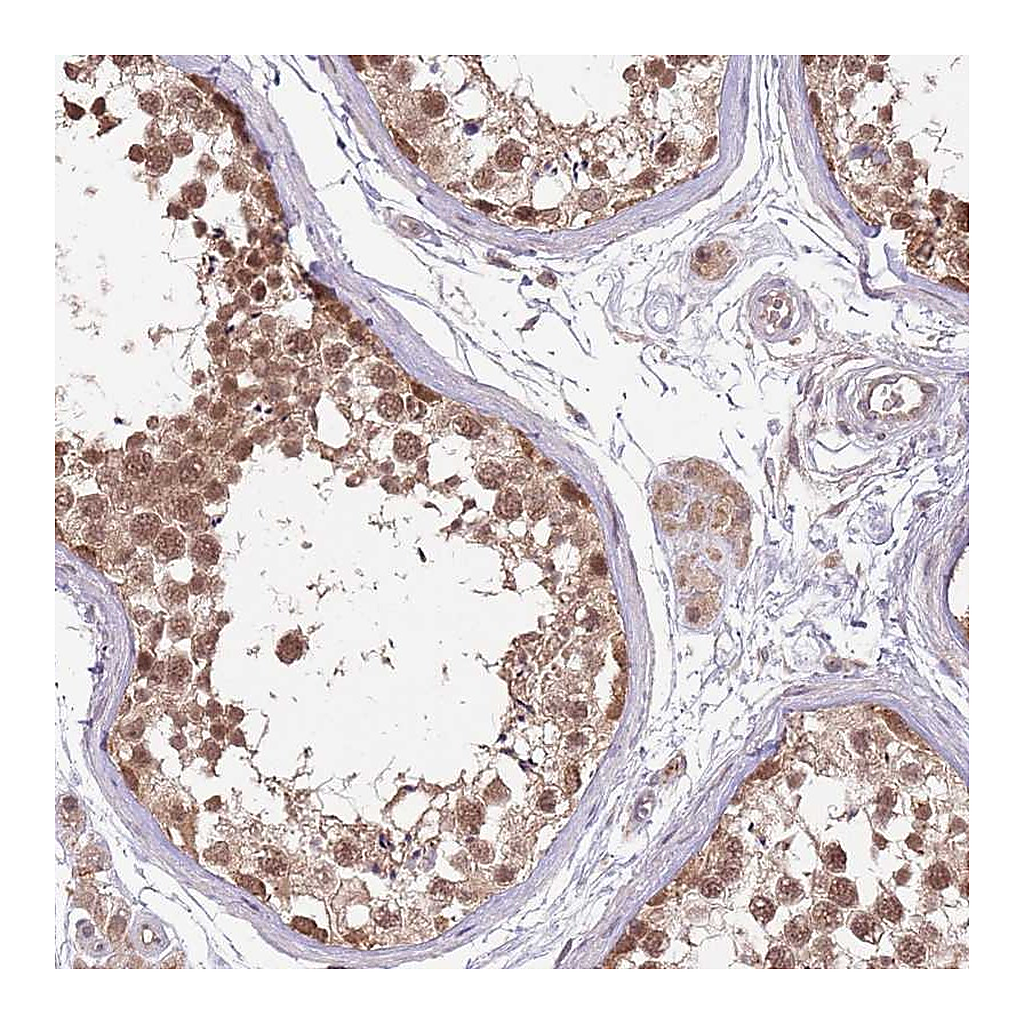 Atlas Antibodies Anti-NBPF4 Antibody