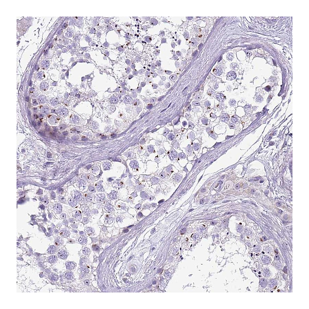 Atlas Antibodies Anti-NBPF4 Antibody