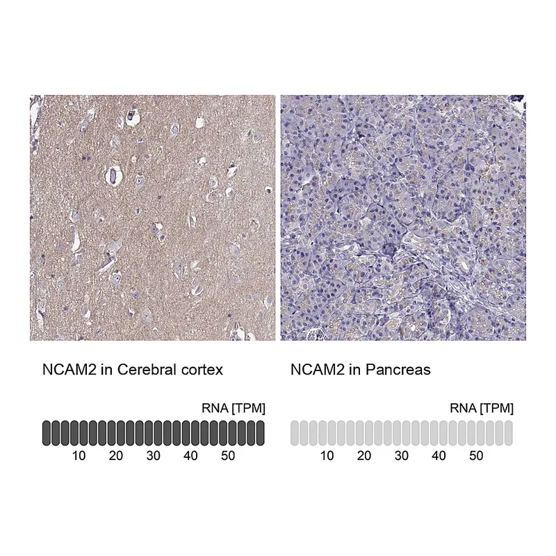 Atlas Antibodies Anti-NCAM2 Antibody