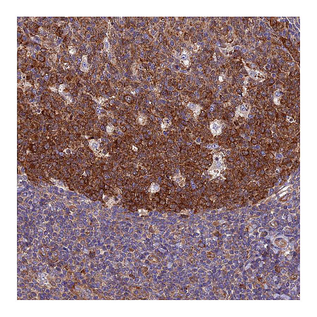 Atlas Antibodies Anti-NCAPG Antibody