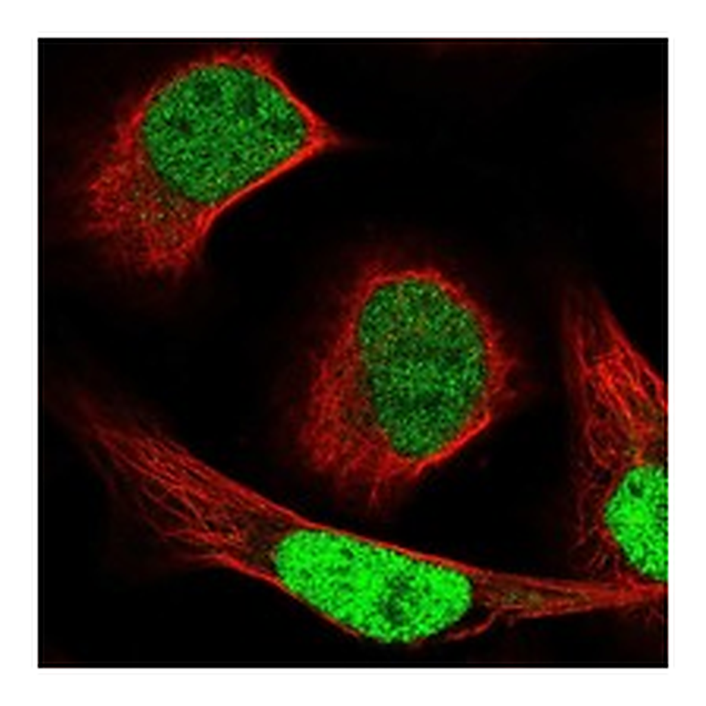 Atlas Antibodies Anti-NCAPG2 Antibody
