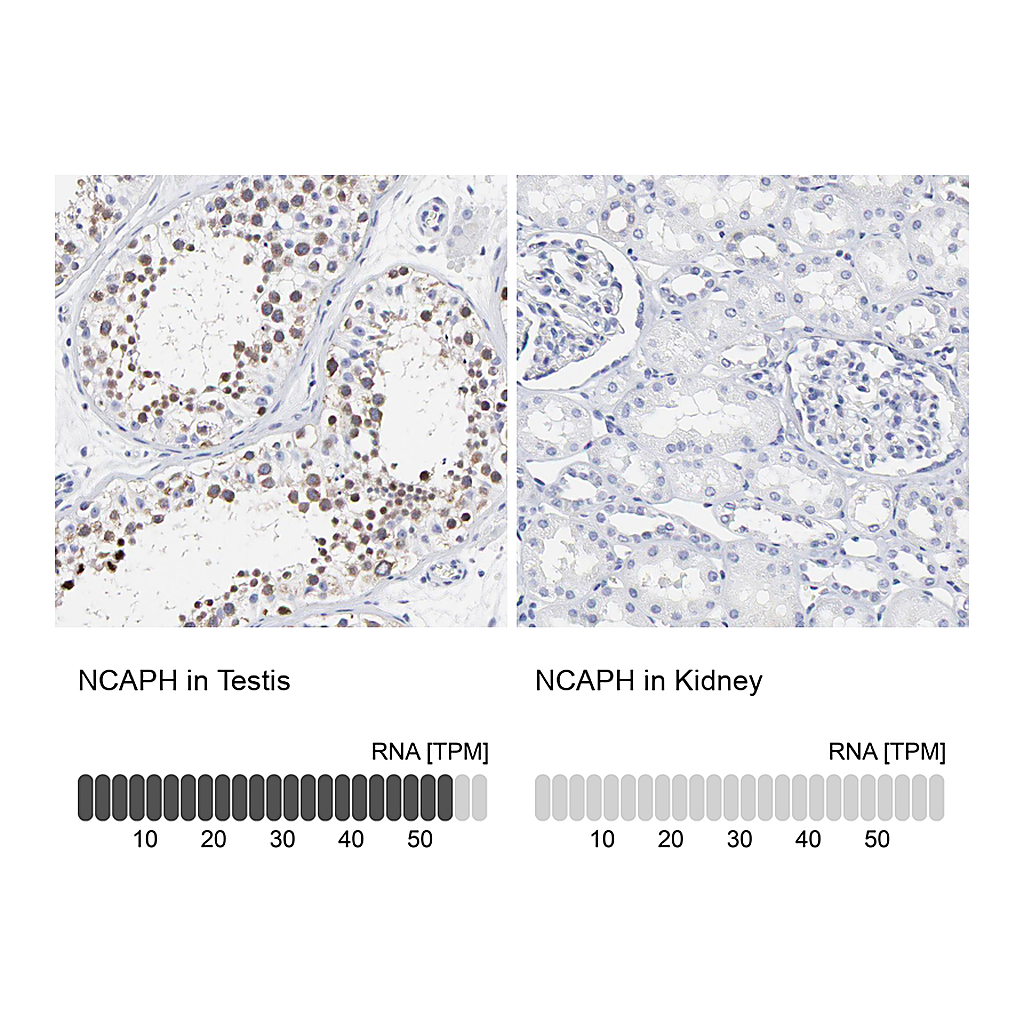 Atlas Antibodies Anti-NCAPH Antibody