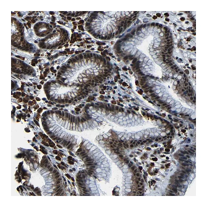 Atlas Antibodies Anti-NCBP3 Antibody