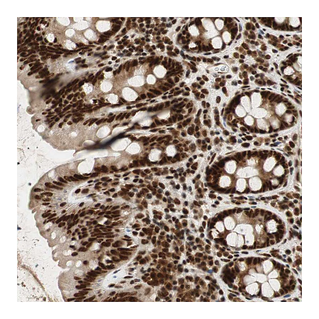 Atlas Antibodies Anti-NCBP3 Antibody